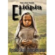 Etiópia - Vysoká škola neočakávania