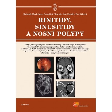 Rinitidy, sinusitidy a nosní polypy